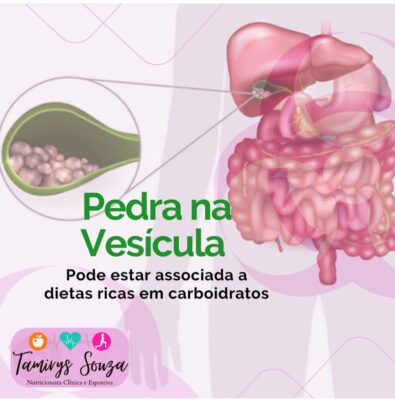 Foto: Divulgação/Dra. Tamirys Souza
