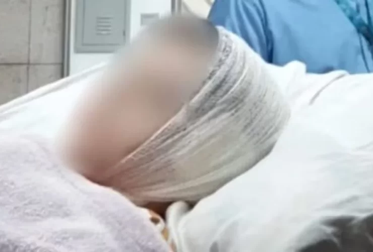 Garoto perdeu parte da orelha após ataque de pitbull nesta quinta-feira (23). (Reprodução/Redes Socias)